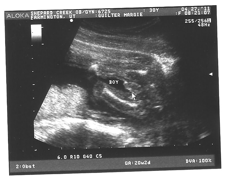 3d ultrasound 20 weeks boy. 3d ultrasound 20 weeks boy. 3d ultrasound 20 weeks boy.