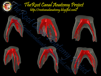 The Root Canal Anatomy Project: Primary molars are easy!