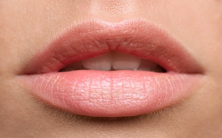 Herpes En Los Labios Herpes En Los Labios