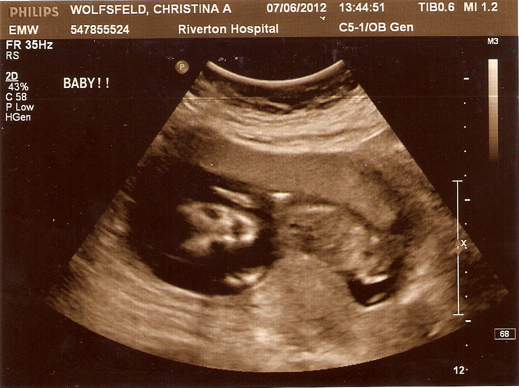 week 9 Pregnancy week 9: your baby is 12 inches tall and weighs 007 oz learn about your baby's development, including photos, fun facts and tips. week 9 Pregnancy week 9: your baby is 12 inches tall and weighs 007 oz learn about your baby's development, including photos, fun facts and tips.