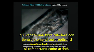 Una Margherita Hack che non conosce HAARP ... strano! Morgellons+Filamento+tubolare
