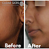 Natural Remedies Tips For Remove Facial Hair