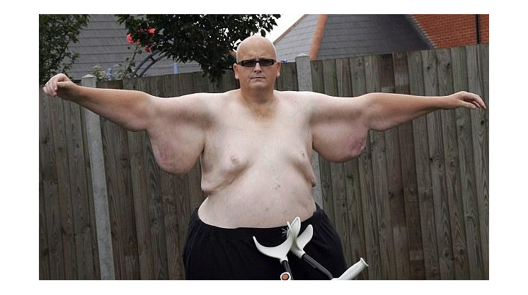 más gordo recogidas públicas más gordo recogidas públicas