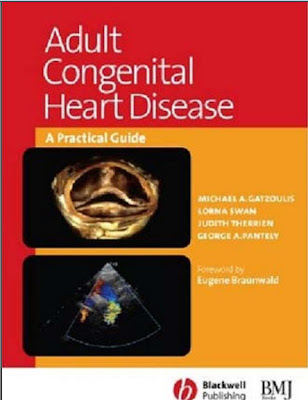 Adult Congenital Heart Disease: A Practical Guide 