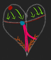 Atrial Flutter Explained Atrial Flutter Explained