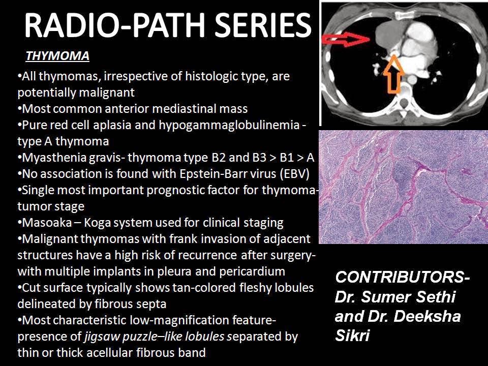 ThymomaRadioPath Series Sumer's Radiology Blog