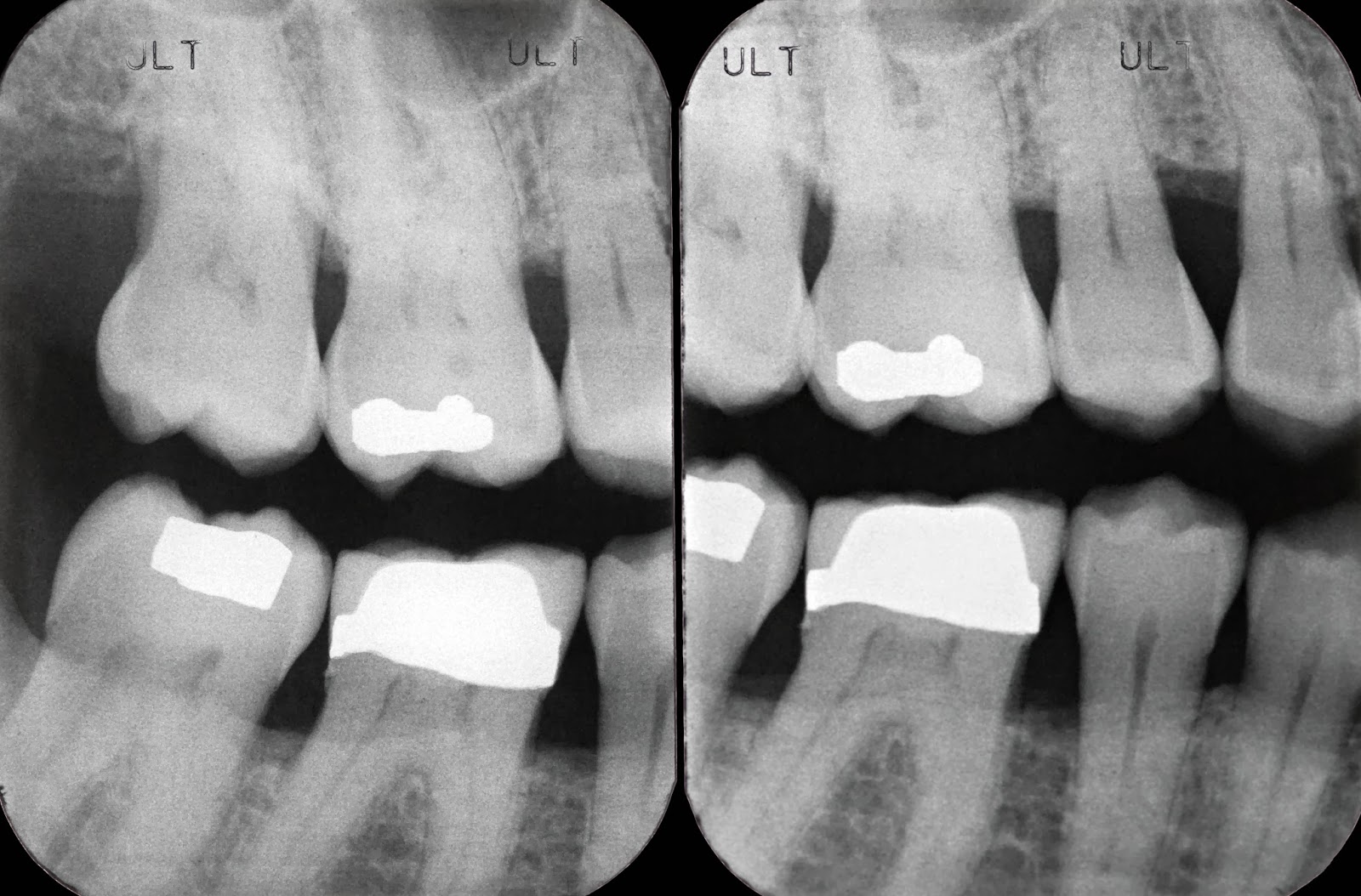 Dentist Brampton, Dental x-Rays,