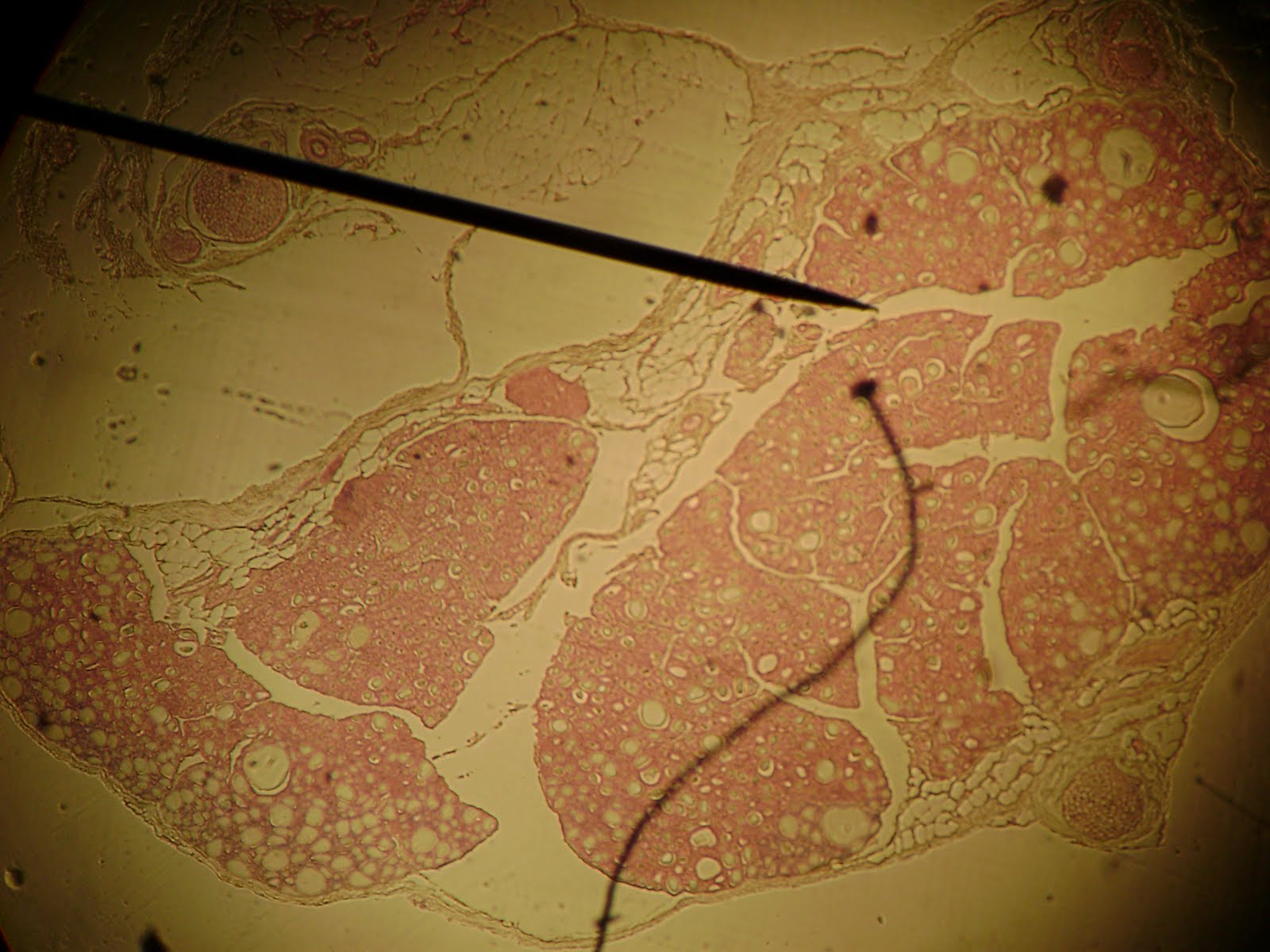 Anatomy and Physiology 2 Eportfolio: The Endocrine System & It's Hormones