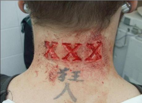 Triple X Scar Tattoo Triple X Scar Tattoo