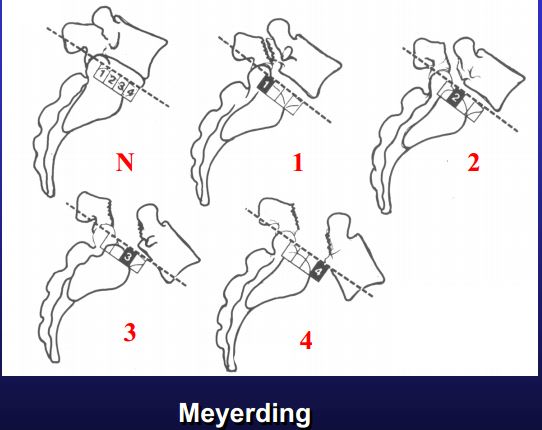 Suffix listhesis meaning picture