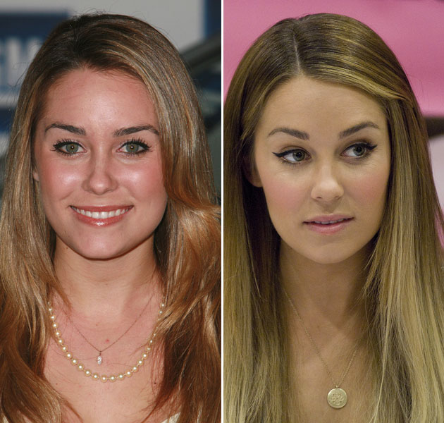 Chatter Busy Lauren Conrad Plastic Surgery