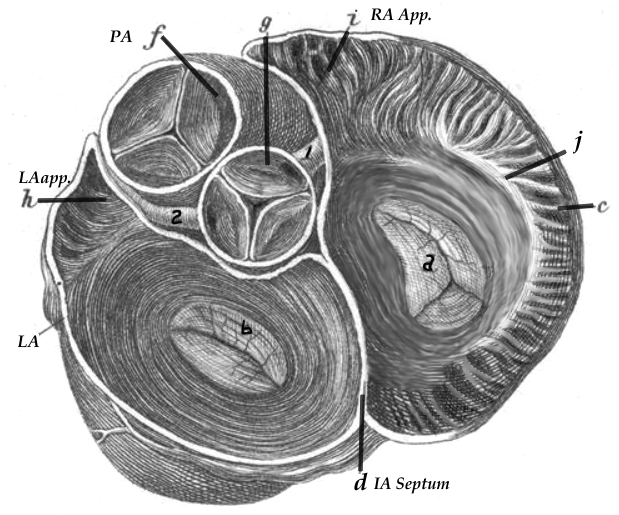 Wes Todd, RCIS, RCES Atrial Anatomy Questions