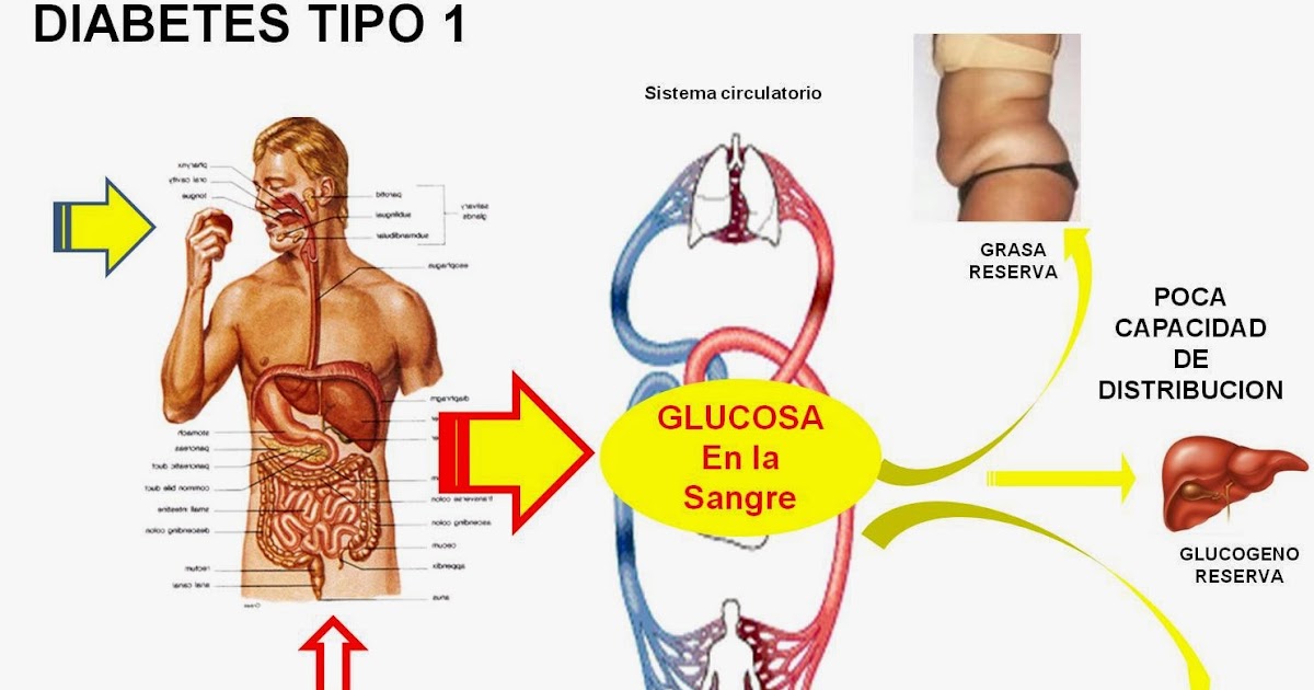 SALUD Y MEDICINA: Descifran el Rompecabezas de la Diabetes SALUD Y MEDICINA: Descifran el Rompecabezas de la Diabetes