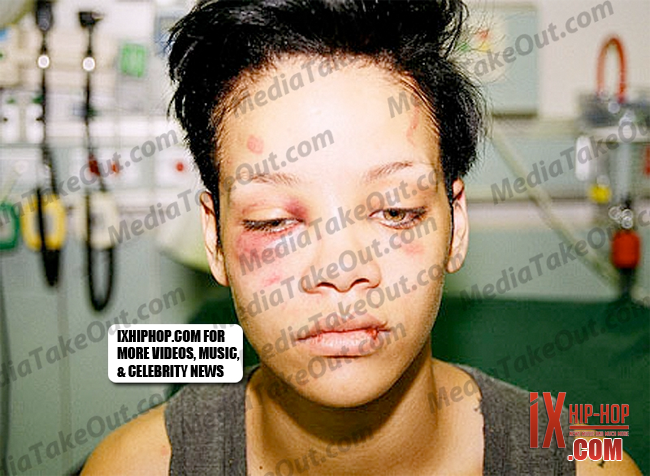 chris brown leaked photos. Rihanna#39;s Chris Brown