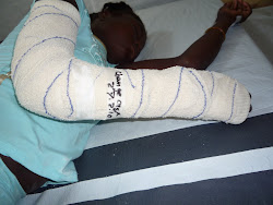 cast with treatment note on tape