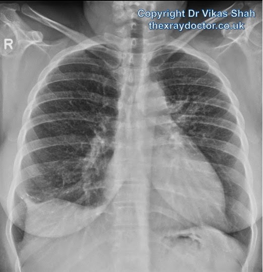 the xray doctor A young woman with shortness of breath
