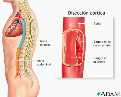 Las consecuencias del dolor en la espalda