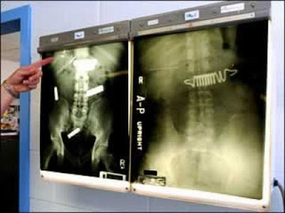 Some Weird And Bizarre X-RAY Pictures