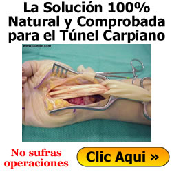 tunel-carpiano-sintomas