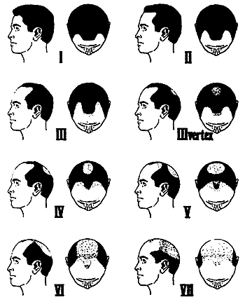 The Beauty Blunder Blog Cosme Terminology Quiz Alopecia