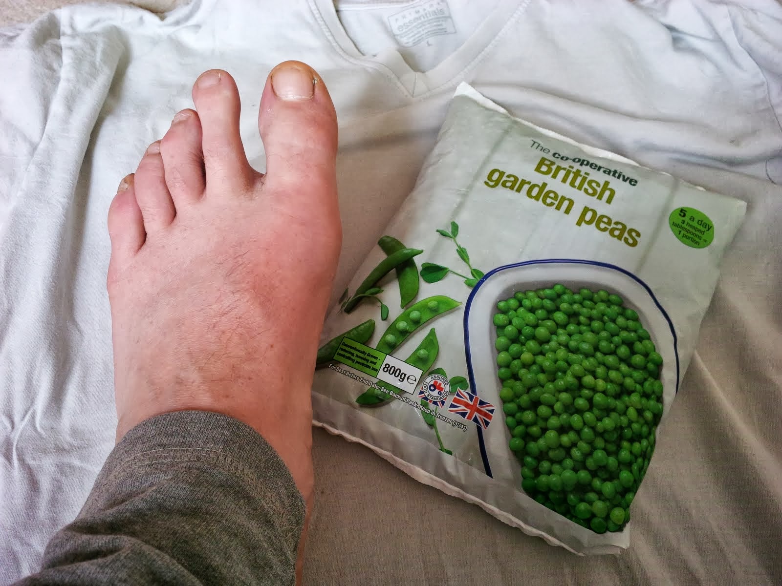 A day in the life of.... Bunions! Seriously?