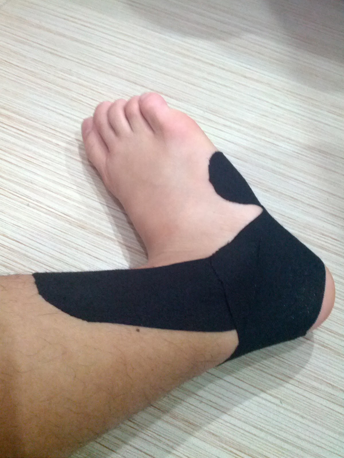 Hello. 2nd Application of Kinesio Tape