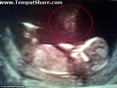 aneh di gambar itu kata lazarou 31 yang tinggal bersama