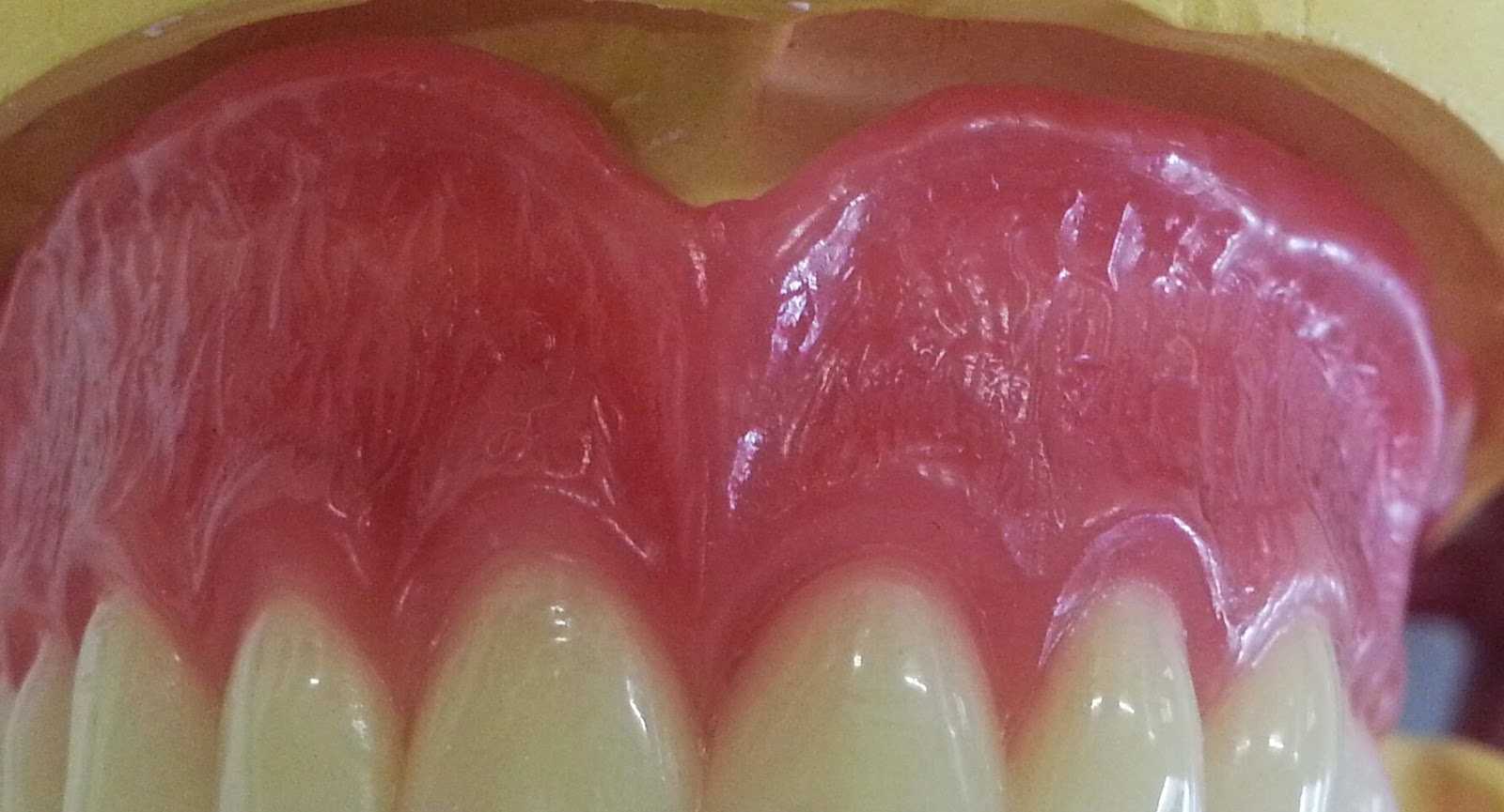 Mrs D's Dental Technology space for student Post your observatios