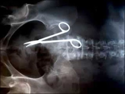 Some Weird And Bizarre X-RAY Pictures