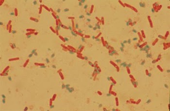 Vi khuẩn Bacillus cereus. Nguồn: Textbook of bacteriology.