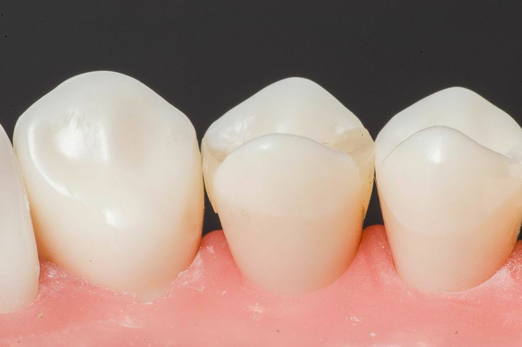 Dental Portfolio 2014