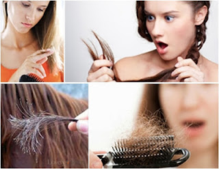 Faktor penyebab masalah rambut tontok dan botak