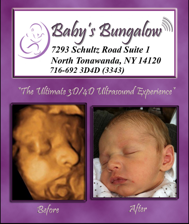 4d ultra sound