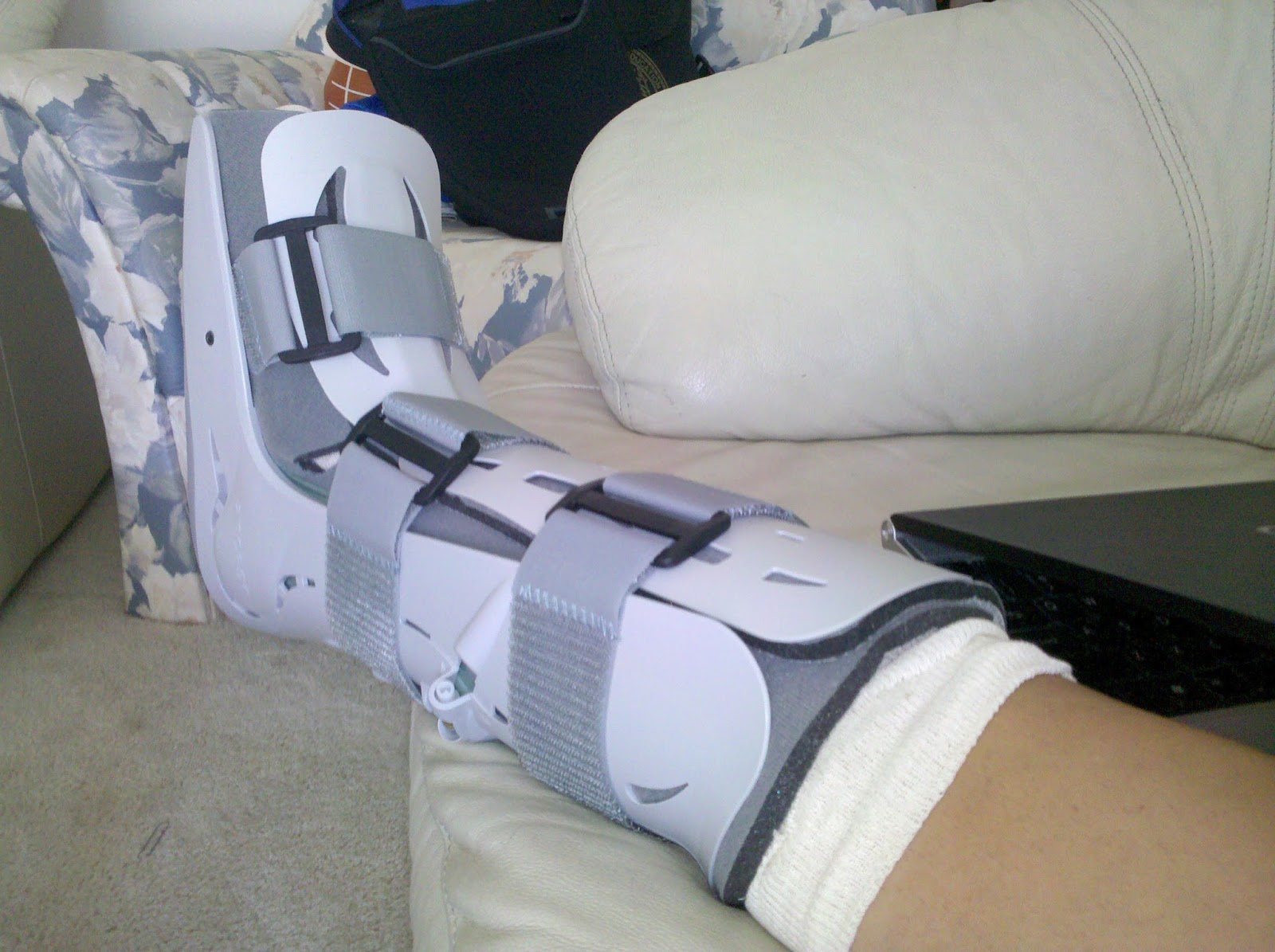 A Better Life with Burgers The Story of My Surgery Part II