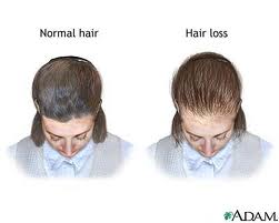 Hair Is Inevitable Bald Is Beautiful Or Is It Some Timely