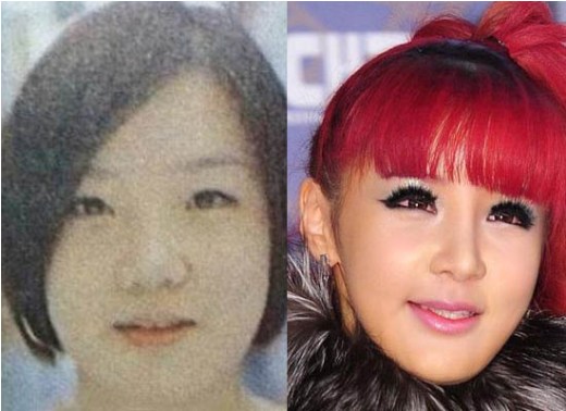 Park+Bom+Before+Surgery Before discussing Park Bom 's surgery , let's examine who is Park Bom.