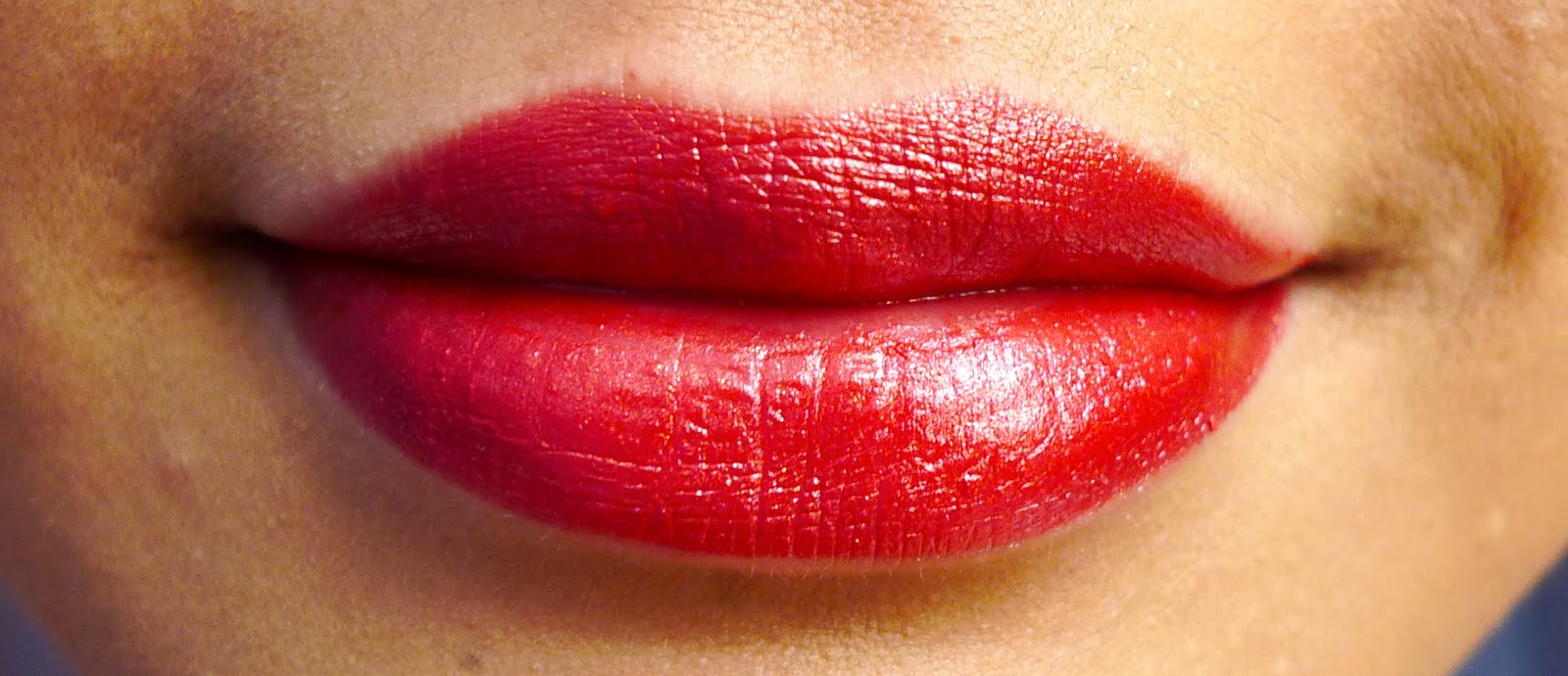 Burn Lip