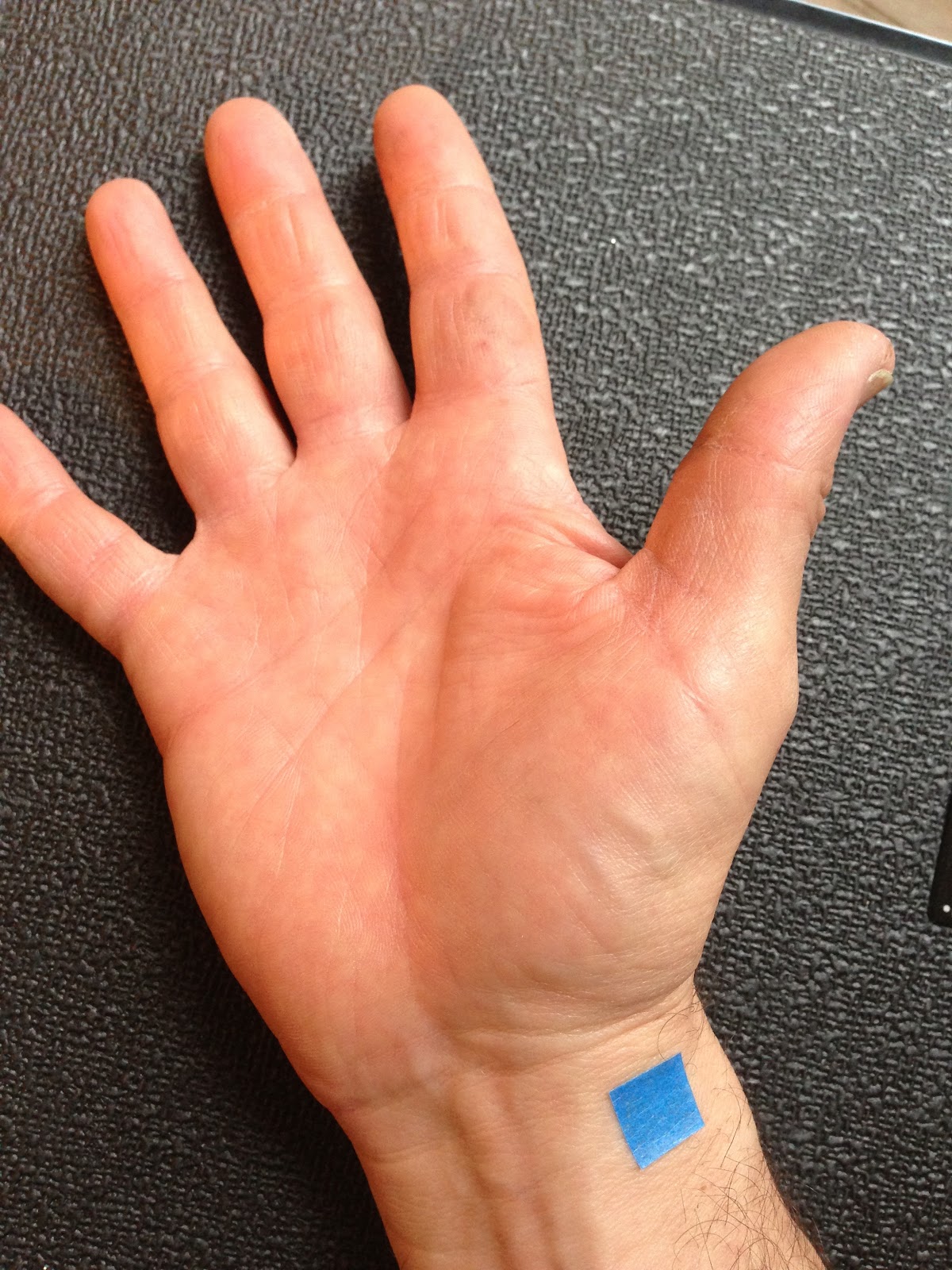 Back In Action Jetlag acupuncture points for traveling