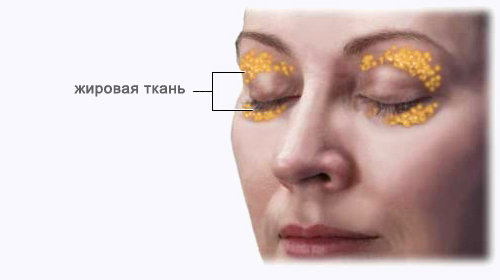 Тяжелые веки с чем связано Тяжелые веки с чем связано