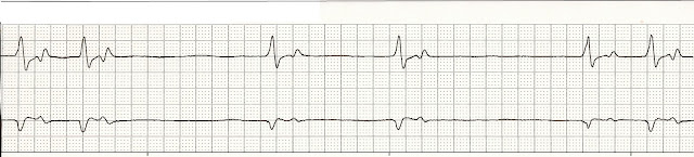 Float Nurse: For in that sleep of death what dreams may come...