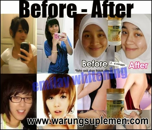 Bukti dan Testimoni Emilay whitening Bukti dan Testimoni Emilay whitening