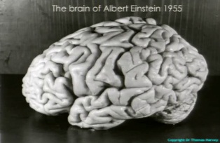 Albert Einstein's Brain
