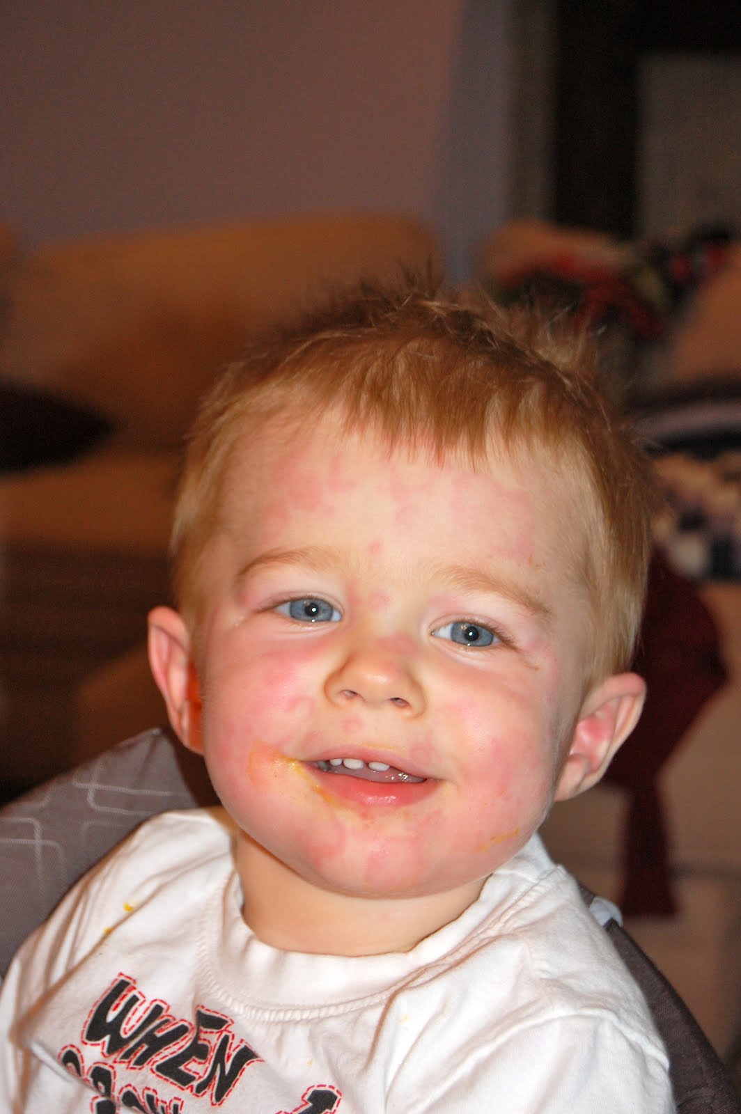 The Pattersons Deacon's weird disease.