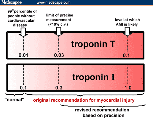 istat troponin procedure istat troponin procedure