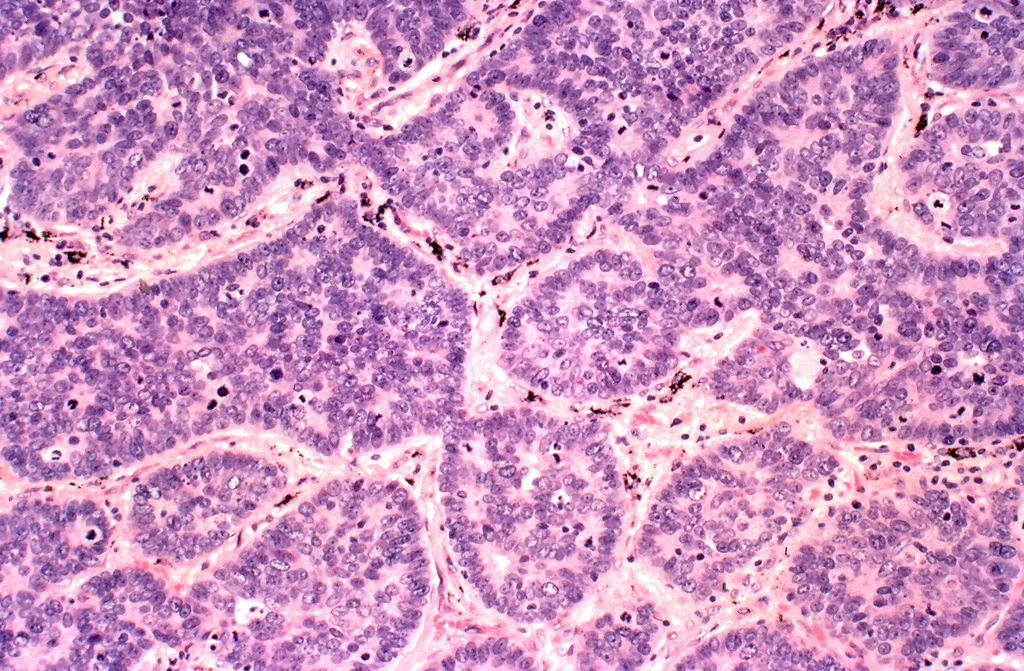 Cell Pathology