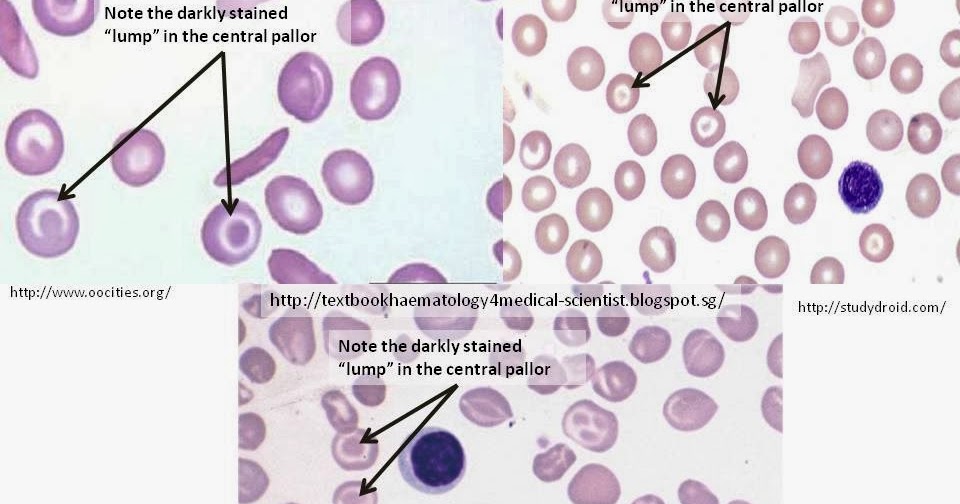 target cell target cell
