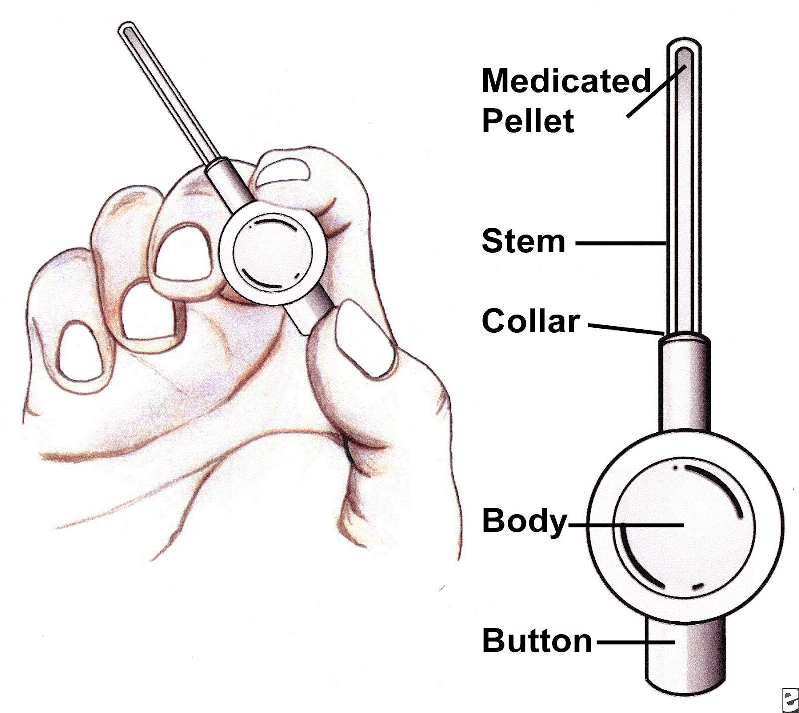 Narrow Urethra Symptoms
