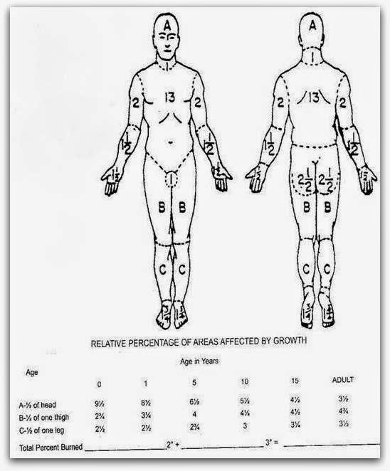 Burn Chart Body