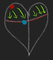 Atrial Flutter Explained Atrial Flutter Explained