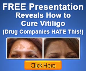Natural Vitiligo Treatment System Review